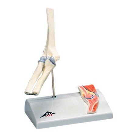 Fabrication Enterprises 3B Anatomical Model - Mini Elbow Joint with Cross Section of Bone on Base 957272